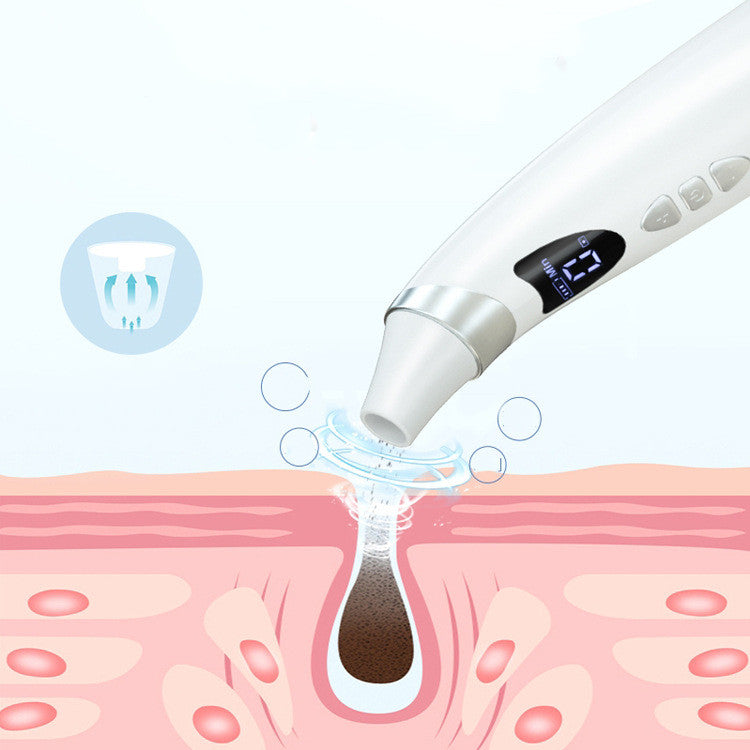 Electric Blackhead Remover & Pore Cleaner - Image 2