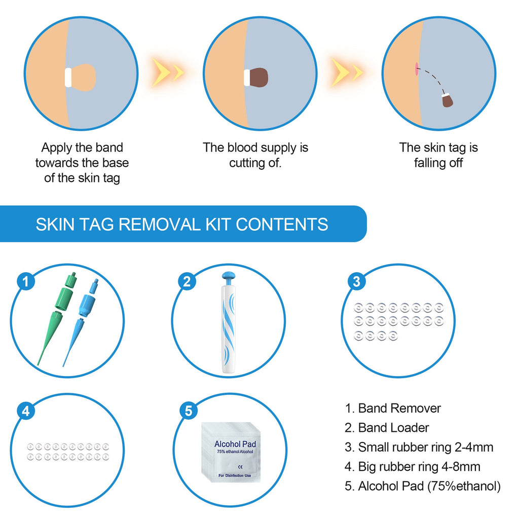 Skin Tag Removal Treatment Tool - Image 3